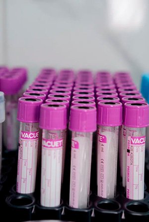 Ампулы для анализов крови